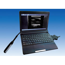 Escáner Digital Veterinario de Ultrasonido Portátil