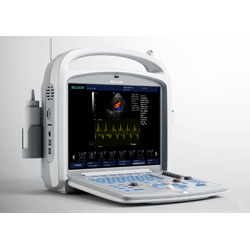 Landytop5000M Escáner Portátil Doppler Color por Ultrasonido